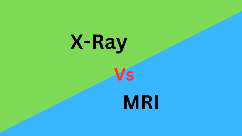 10-differences-between-x-ray-and-mri-with-table-core-differences