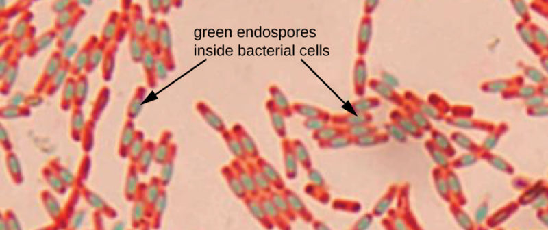 Difference between Bacterial Endospores and Vegetative Cells