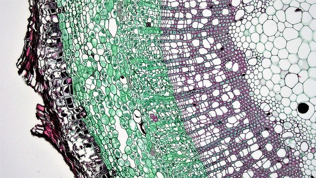 Difference between Stomata and Hydathodes
