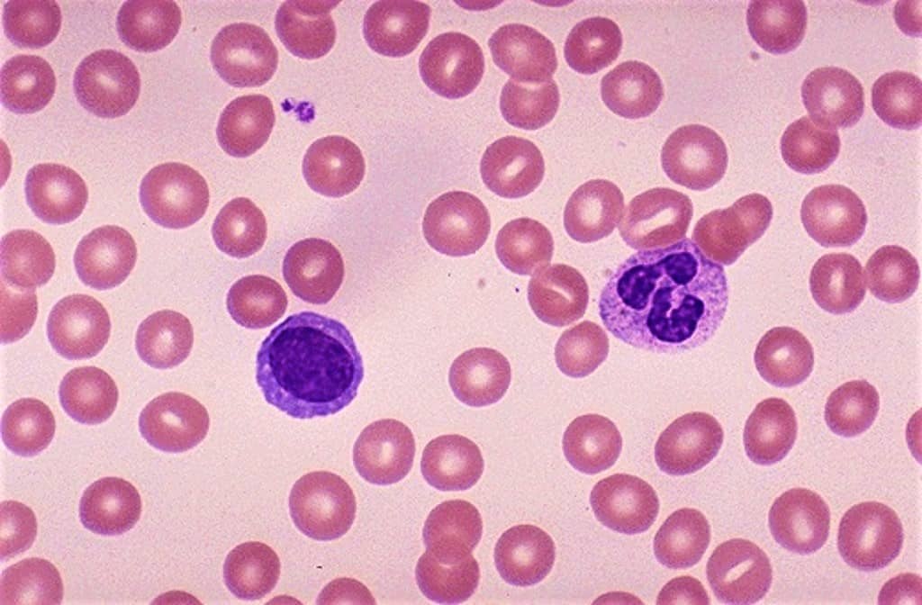difference between giemsa stain and wright stain