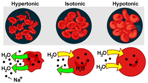 difference between hypertonic and hypotonic solutions